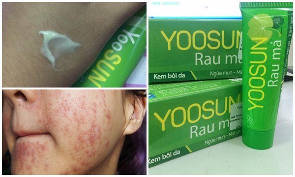 yoosun-tri-mun-dau-do