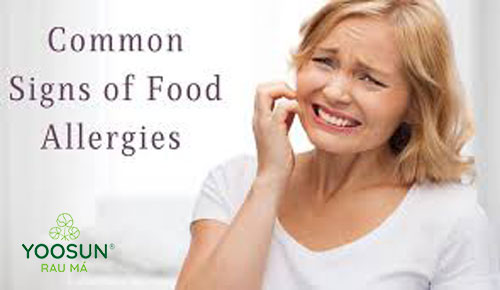 triệu chứng khi bị dị ứng thực phẩm