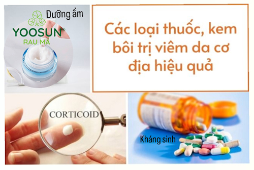 Cách điều trị viêm da cơ địa quanh miệng