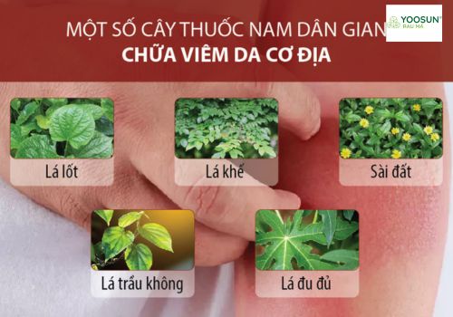 Cây thuốc nam trị viêm da cơ địa