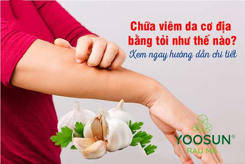 Chữa viêm da cơ địa bằng tỏi như thế nào