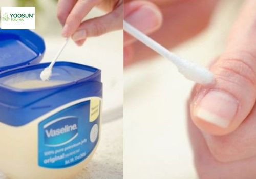 Cách dùng vaseline cho người bị viêm da cơ địa