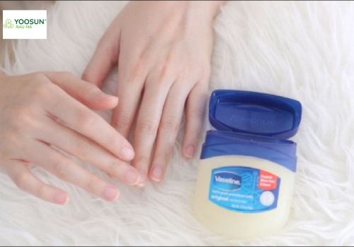 Viêm da cơ địa thoa vaseline 