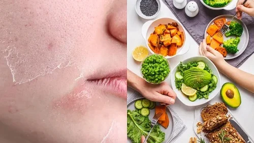 Da khô nên ăn gì tốt nhất 