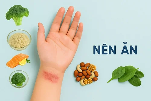 bị bỏng ăn gì mau lành vết thương