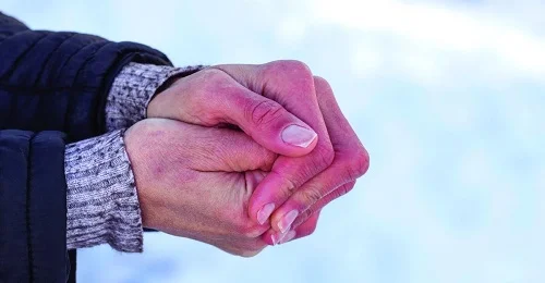 Bị bỏng nhiệt nên làm gì là tốt nhất
