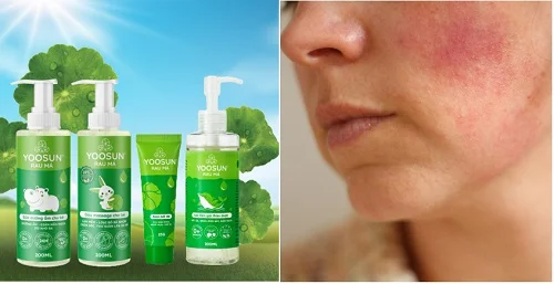 Bộ sản phẩm Yoosun Rau má có bắt nắng không? Câu trả lời khiến bạn bất ngờ