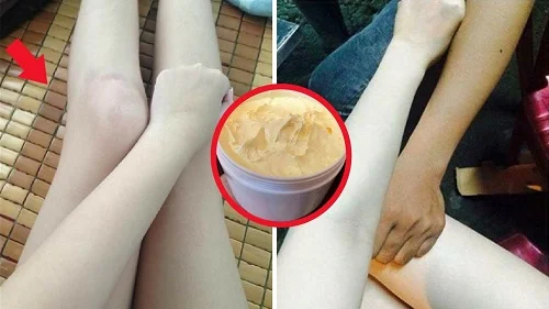 Yoosun Rau má có phải kem trộn không