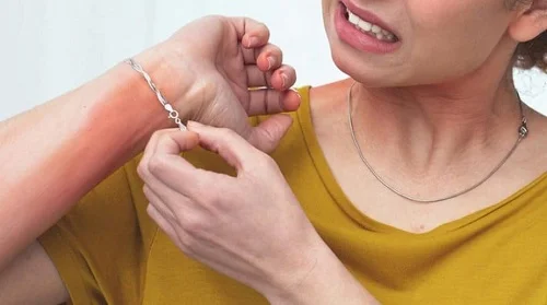 Dị ứng bạc giả: Đừng bỏ qua nếu bạn hay đeo trang sức bạc!