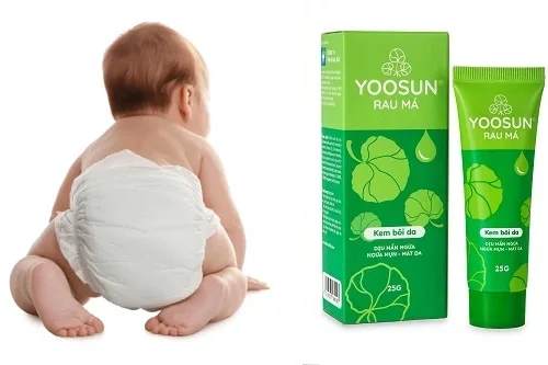 Kem Yoosun Rau má có trị hăm không? Đừng lầm tưởng