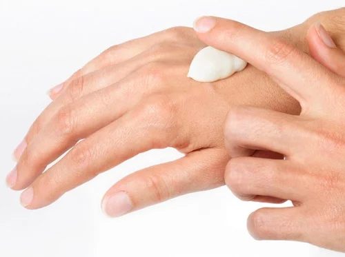 Bị dị ứng kem trộn body phải làm sao