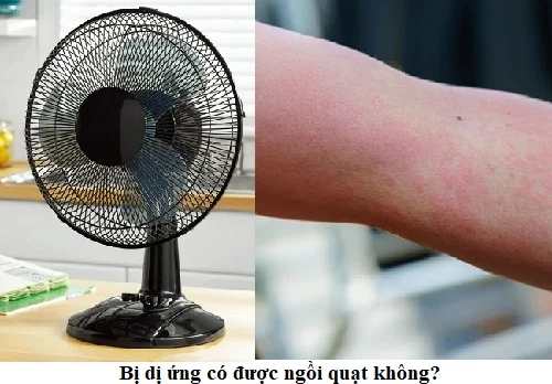 Bị dị ứng có được ngồi quạt không? Giải đáp và lưu ý khi dùng