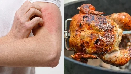 Bị dị ứng có ăn được thịt gà không? Giải đáp chi tiết