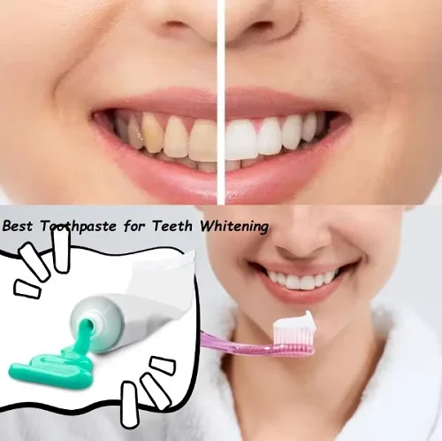 Tại sao bị dị ứng với kem đánh răng