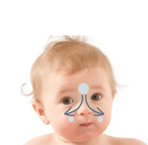 Cách massage cho trẻ bị nghẹt mũi