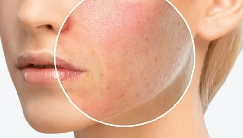 Lưu ý khi sử dụng cách massage với dầu oliu Cách massage với dầu oliu