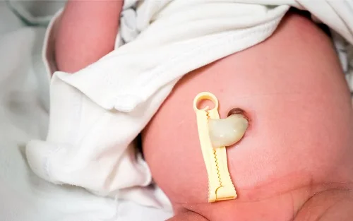 Cách tắm cho trẻ sơ sinh chưa rụng rốn như thế nào cho dúng Cách tắm cho trẻ sơ sinh chưa rụng rốn