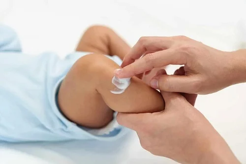 Dưỡng ẩm cho bé viêm da cơ địa nên lựa chọn thế nào Dưỡng ẩm cho bé viêm da cơ địa