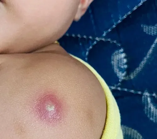 Sau tiêm phòng có nên tắm cho bé không? Giải đáp Sau tiêm phòng có nên tắm cho bé không