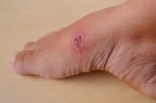 Chia sẻ Cách tắm lá chè xanh cho người lớn Tắm lá chè xanh cho người lớn