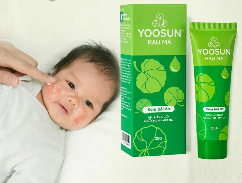 Cách chữa dị ứng nước hồ bơi