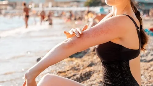 Cách nhận biết dị ứng nước biển và cách xử lý nhanh