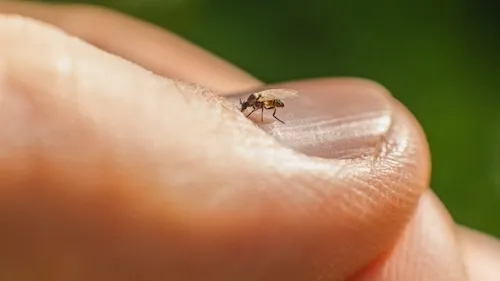 bị con dĩn đốt bôi thuốc gì
