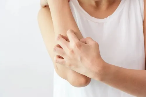 cách trị dị ứng khi ăn nhộng ong