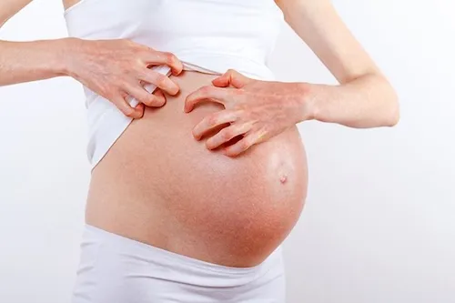 bị dị ứng có nên uống nước dừa