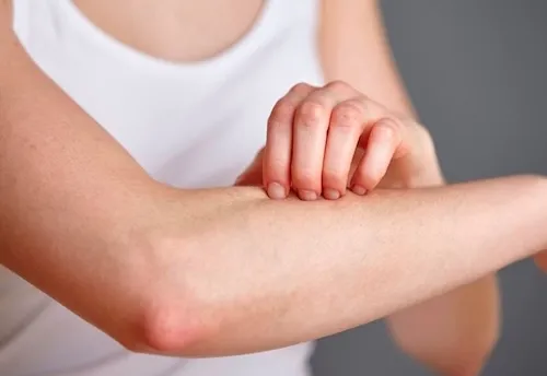 dị ứng uống nước dừa được không