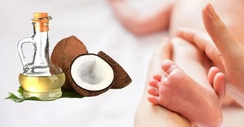 Cách chữa chàm sữa bằng dầu dừa nguyên chất