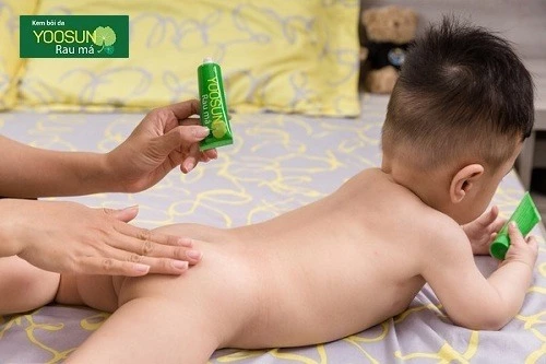 bé nổi mụn nước ở tay chân