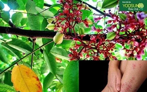 Cách điều trị viêm da tiếp xúc dị ứng