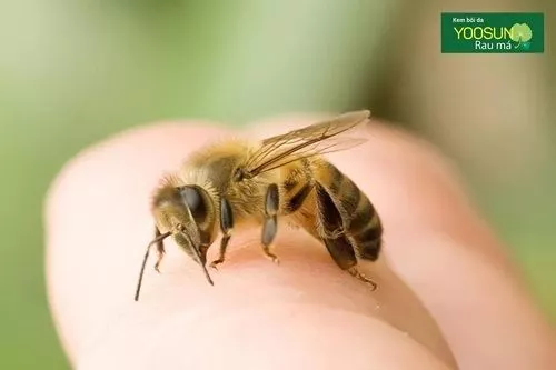 Bị ong chích tốt hay xấu