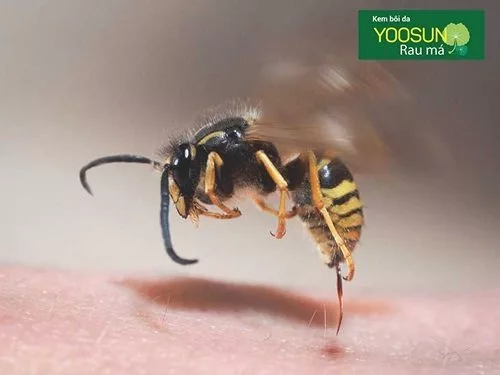 Bị ong đốt không nên ăn gì