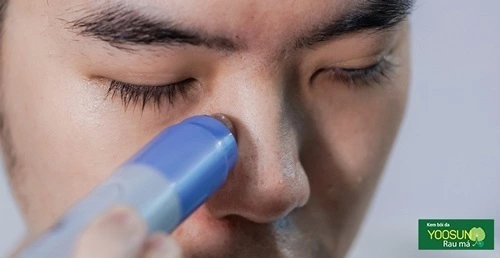 Cách trị sợi bã nhờn dưới cằm