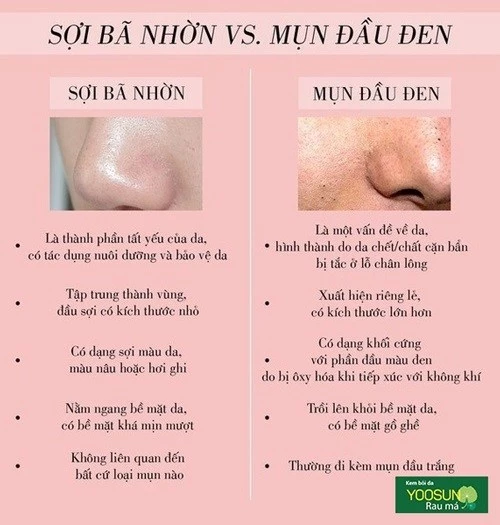Sợi bã nhờn và mụn đầu đen