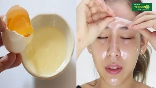 Trị thâm mụn hiệu quả tại nhà bằng lòng trắng trứng gà