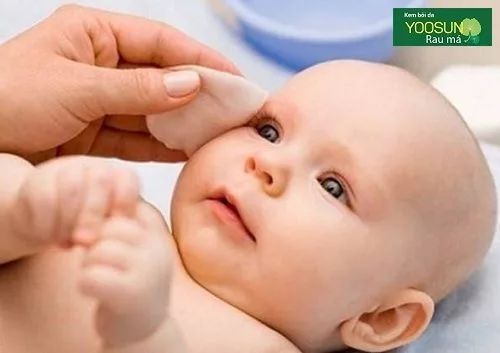 Bệnh ngoài da thường gặp ở trẻ em