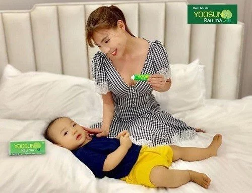 Kem bôi trị muỗi đốt cho bé