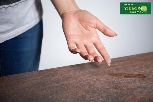 Dị ứng mạt bụi nhà phải làm thế nào? dị ứng mạt bụi nhà