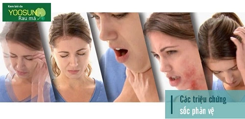 Bị dị ứng baba phải làm sao