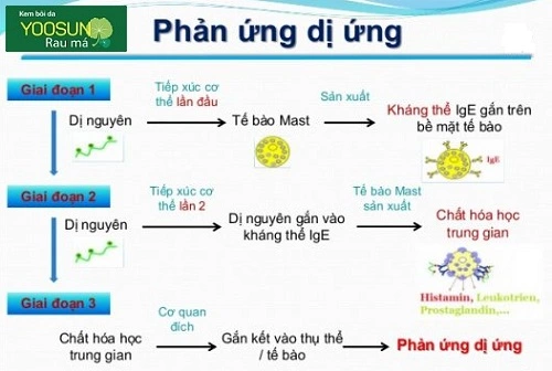 Bị dị ứng là gì