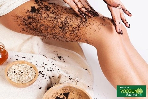 Cách trị dị ứng kem body
