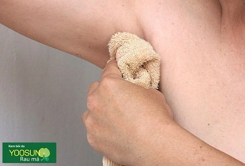 Cách trị mụn nách
