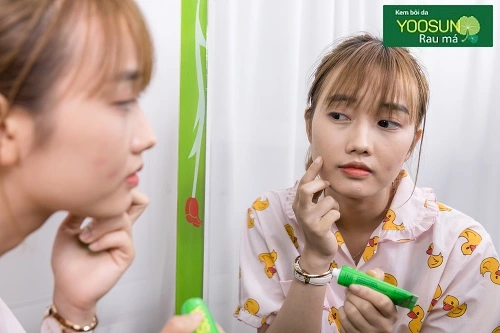 Cách trang điểm cho da mụn và thâm
