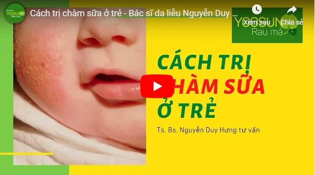 Video cách chữa bệnh chàm bằng dầu dừa