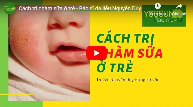 Video cách chữa chàm sữa ở trẻ sơ sinh