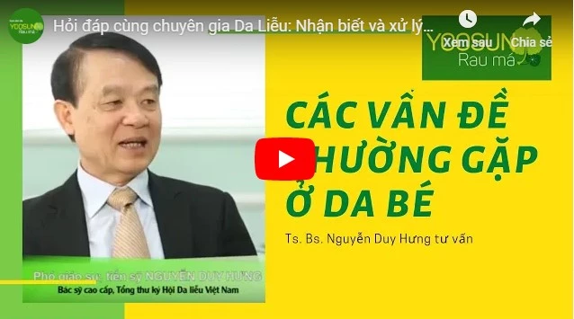Video cách chữa chốc mép tại nhà