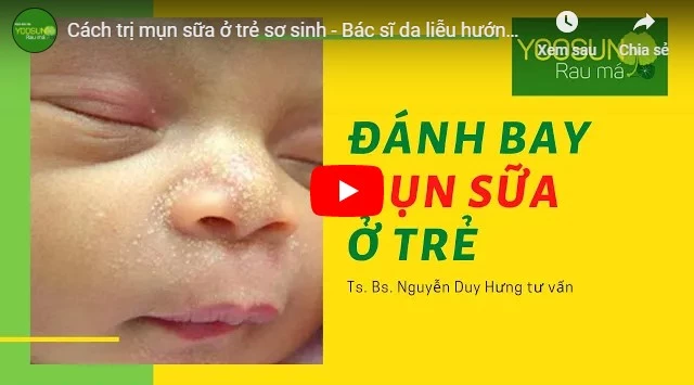 Video cách chữa mụn nhọt ở trẻ em